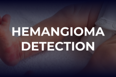 Hemangioma Detection